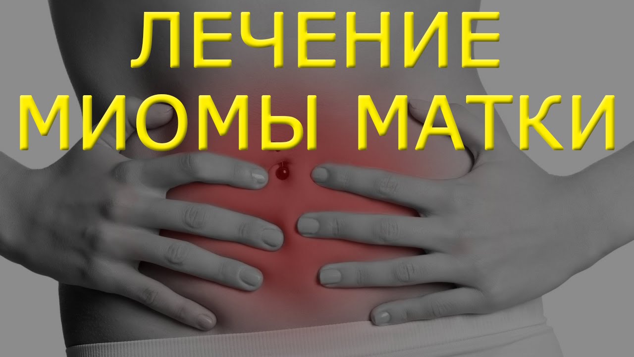 Фото:Как вылечить миому?